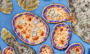 Tiêm virus vào cơ thể để thử nghiệm thuốc ung thư Tiêm virus vào cơ thể để thử nghiệm thuốc ung thư